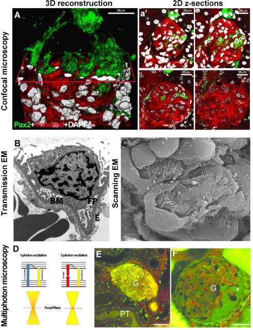 FIGURE 1: (A) 3D reconstruction of a glomerulus from a 50-lm-thick kidney section, showing de novo podocyte regeneration in a transgenic mouse model of adriamycin-induced nephropathy.