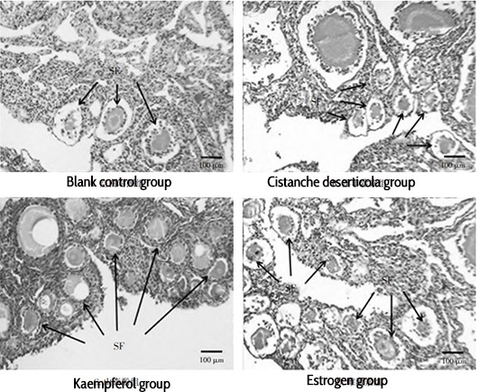 005 Figure 4 Ovarian tissue after HE staining (10 ×）